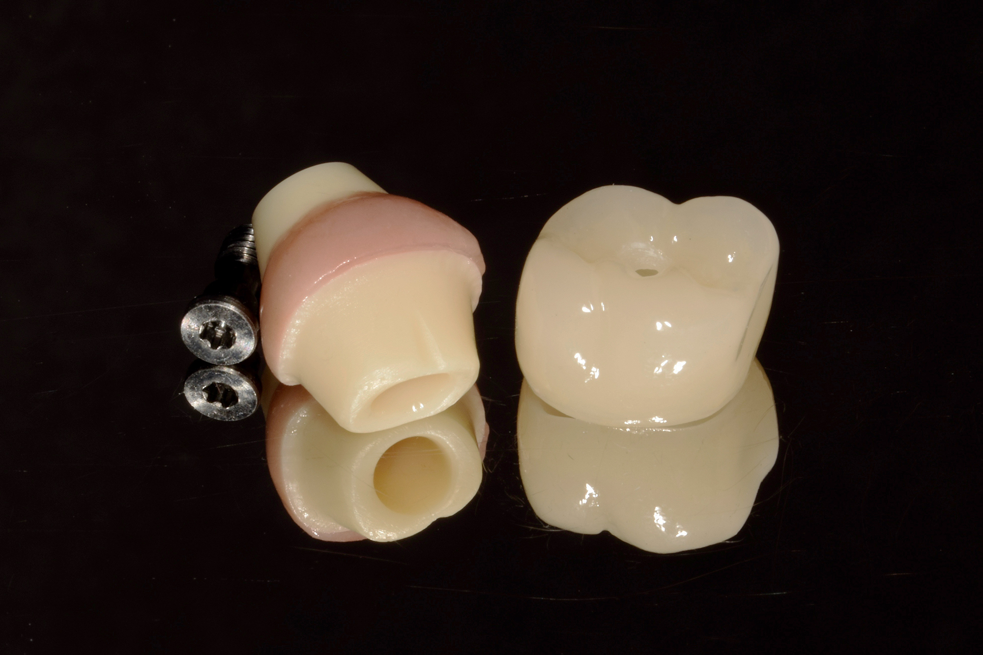 Zirconia Abutment with gum porcelain